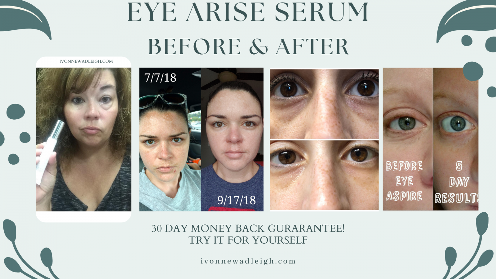 Before and After photos for Eye Arise Serum